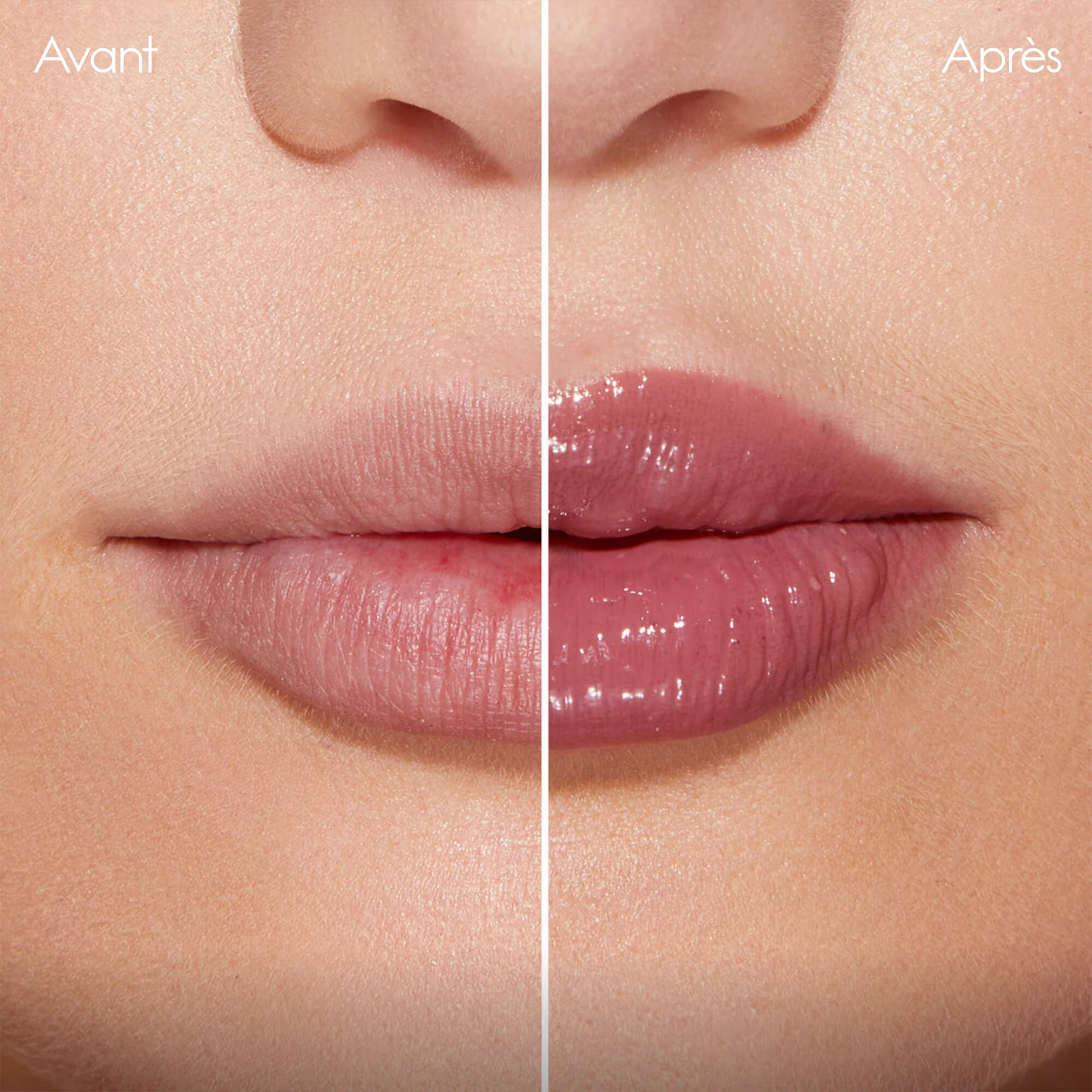 XXL Lip Plumper  — Achetez 2+1 Gratuit