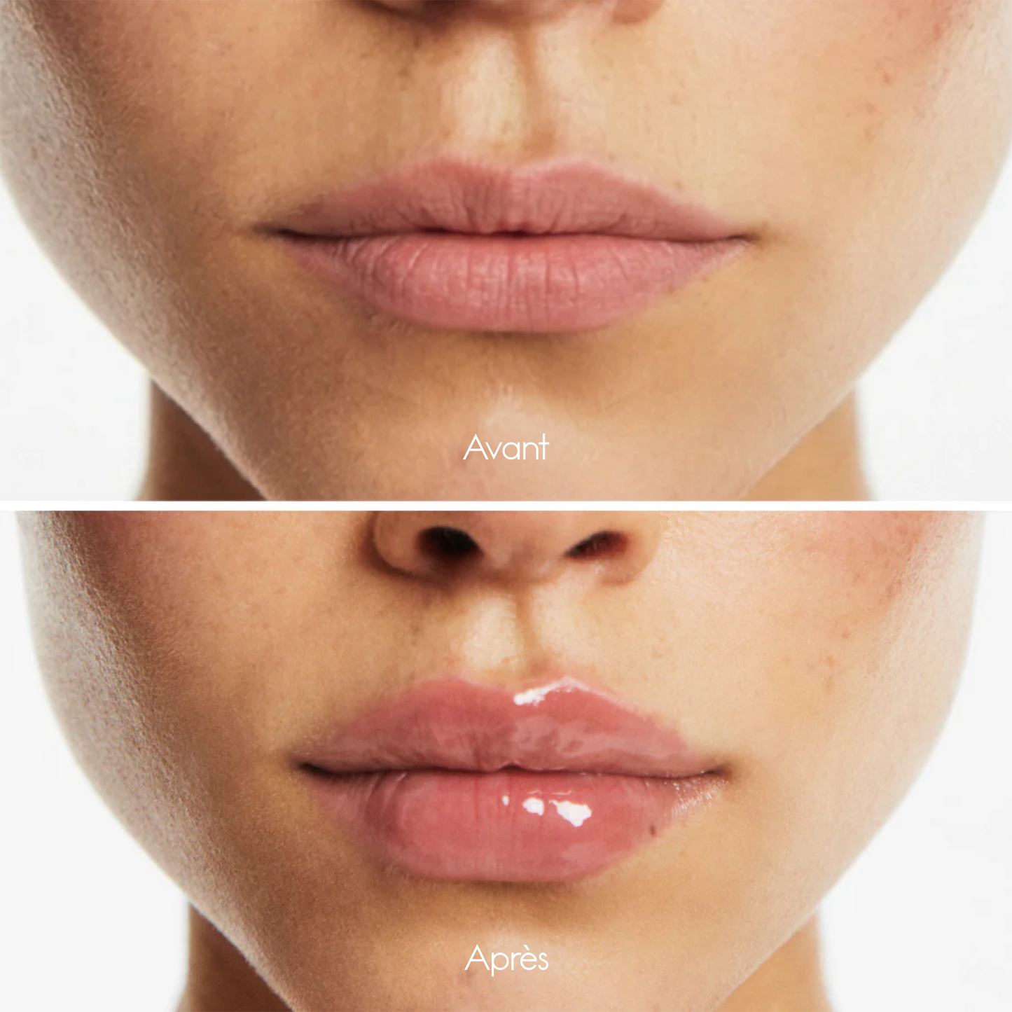 XL Lip Plumpler